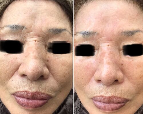 8DC0F3D7-D294-4A41-8A42-2243729CFFAD