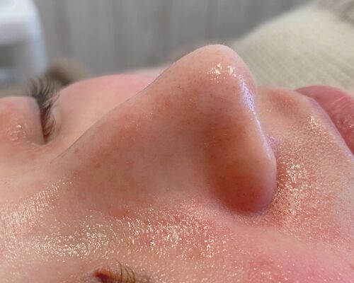 92B3B64F-AC4F-44F8-9684-ECC984D5DCED