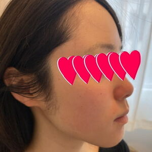 6D47FCCD-216B-479A-ADDE-4AD9C8DD1795